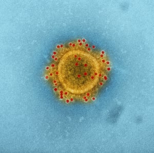 Αυτός είναι ο ιός που είναι σχεδόν βέβαιο πως σας έχει μολύνει