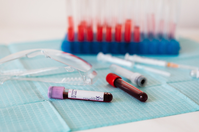 Νέο «έξυπνο» τεστ αίματος ανιχνεύει έναν από τους συχνότερους καρκίνους